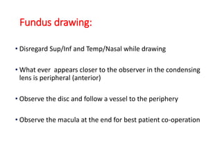 Fundus drawing:
• Disregard Sup/Inf and Temp/Nasal while drawing
• What ever appears closer to the observer in the condensing
lens is peripheral (anterior)
• Observe the disc and follow a vessel to the periphery
• Observe the macula at the end for best patient co-operation
 