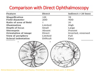 Comparison with Direct Ophthalmoscopy
Retinal Detachment: Principles and Practice, Third Edition Daniel A. Brinton and C. P. Wilkinson
 