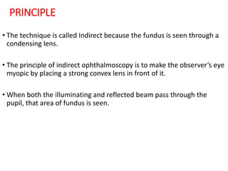 PRINCIPLE O
F INDIRECT OPHTHALMOSCOPY• The technique is called Indirect because the fundus is seen through a
condensing lens.
• The principle of indirect ophthalmoscopy is to make the observer’s eye
myopic by placing a strong convex lens in front of it.
• When both the illuminating and reflected beam pass through the
pupil, that area of fundus is seen.
 
