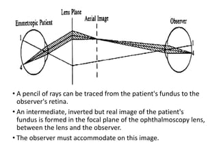 • A pencil of rays can be traced from the patient's fundus to the
observer's retina.
• An intermediate, inverted but real image of the patient's
fundus is formed in the focal plane of the ophthalmoscopy lens,
between the lens and the observer.
• The observer must accommodate on this image.
 