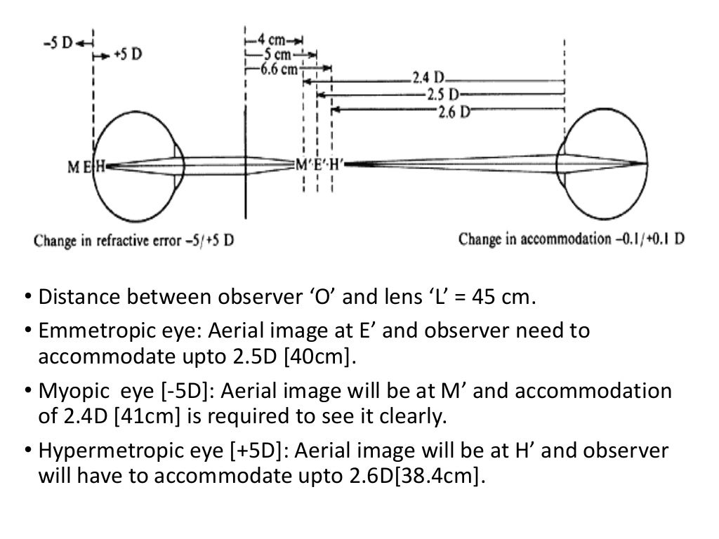 Indirect ophthalmoscopy