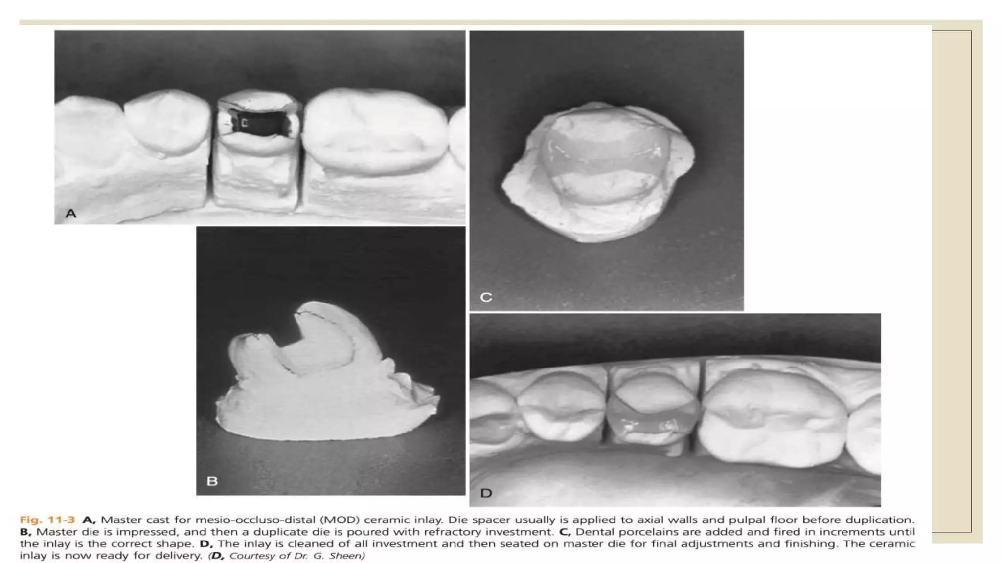Indirect Line INDIRECT RESTORATIONS.pptx
