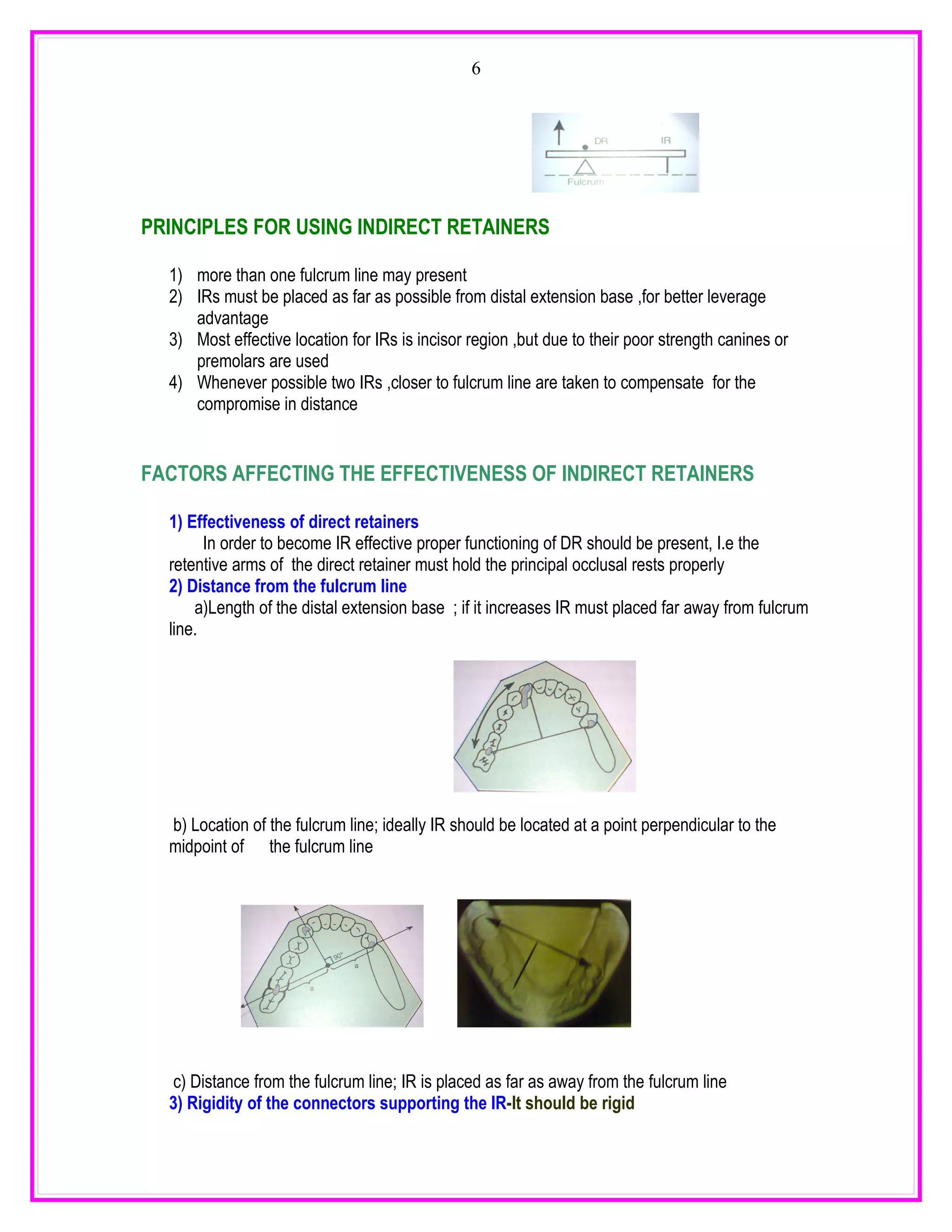 6




PRINCIPLES FOR USING INDIRECT RETAINERS

  1) more than one fulcrum line may present
  2) IRs must be placed as far as possible from distal extension base ,for better leverage
     advantage
  3) Most effective location for IRs is incisor region ,but due to their poor strength canines or
     premolars are used
  4) Whenever possible two IRs ,closer to fulcrum line are taken to compensate for the
     compromise in distance


FACTORS AFFECTING THE EFFECTIVENESS OF INDIRECT RETAINERS

  1) Effectiveness of direct retainers
        In order to become IR effective proper functioning of DR should be present, I.e the
  retentive arms of the direct retainer must hold the principal occlusal rests properly
  2) Distance from the fulcrum line
      a)Length of the distal extension base ; if it increases IR must placed far away from fulcrum
  line.




  b) Location of the fulcrum line; ideally IR should be located at a point perpendicular to the
  midpoint of the fulcrum line




   c) Distance from the fulcrum line; IR is placed as far as away from the fulcrum line
  3) Rigidity of the connectors supporting the IR-It should be rigid
 