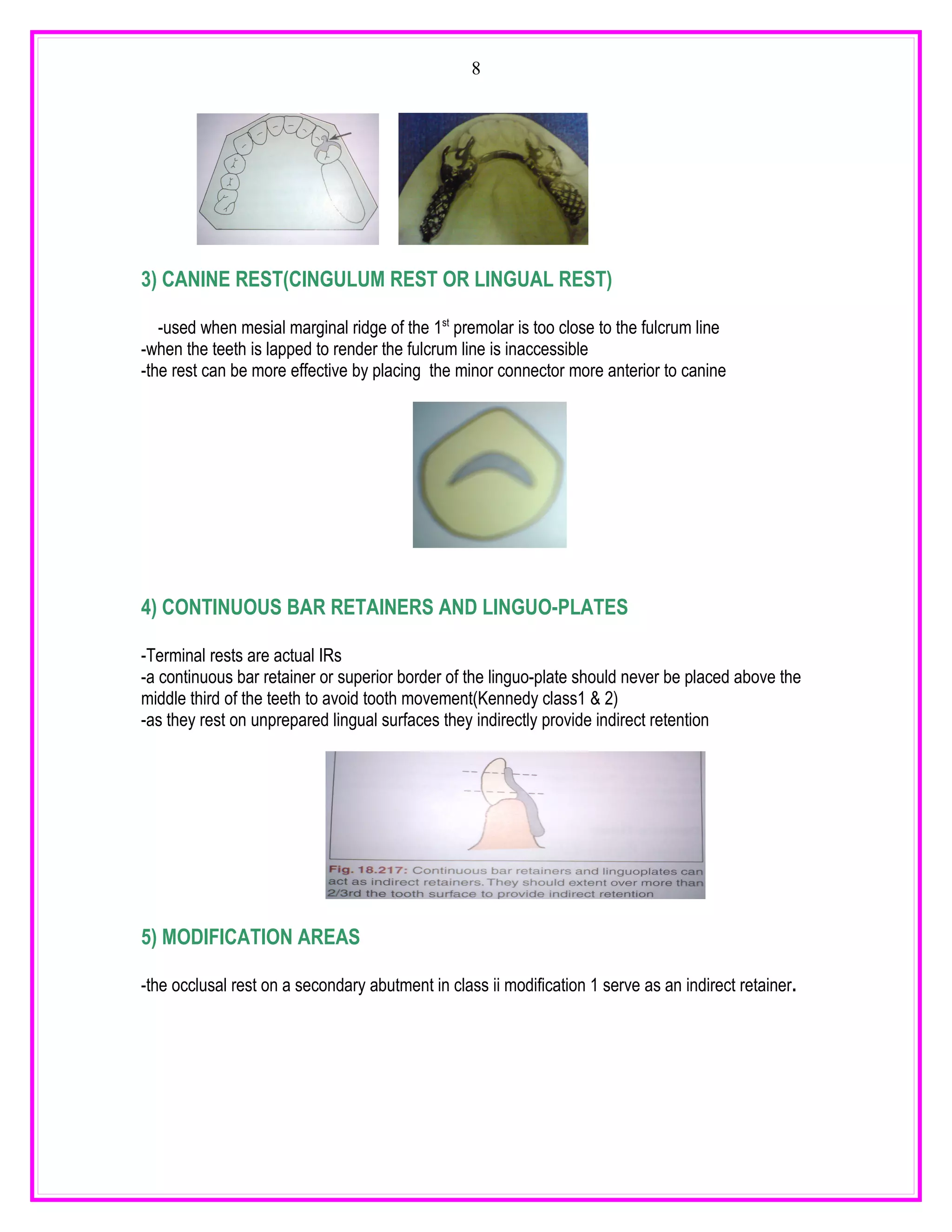 8




3) CANINE REST(CINGULUM REST OR LINGUAL REST)

   -used when mesial marginal ridge of the 1st premolar is too close to the fulcrum line
-when the teeth is lapped to render the fulcrum line is inaccessible
-the rest can be more effective by placing the minor connector more anterior to canine




4) CONTINUOUS BAR RETAINERS AND LINGUO-PLATES

-Terminal rests are actual IRs
-a continuous bar retainer or superior border of the linguo-plate should never be placed above the
middle third of the teeth to avoid tooth movement(Kennedy class1 & 2)
-as they rest on unprepared lingual surfaces they indirectly provide indirect retention




5) MODIFICATION AREAS

-the occlusal rest on a secondary abutment in class ii modification 1 serve as an indirect retainer.
 