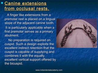 Canine extensionsCanine extensions
from occlusal rests.from occlusal rests.
A finger like extensions from aA finger like...