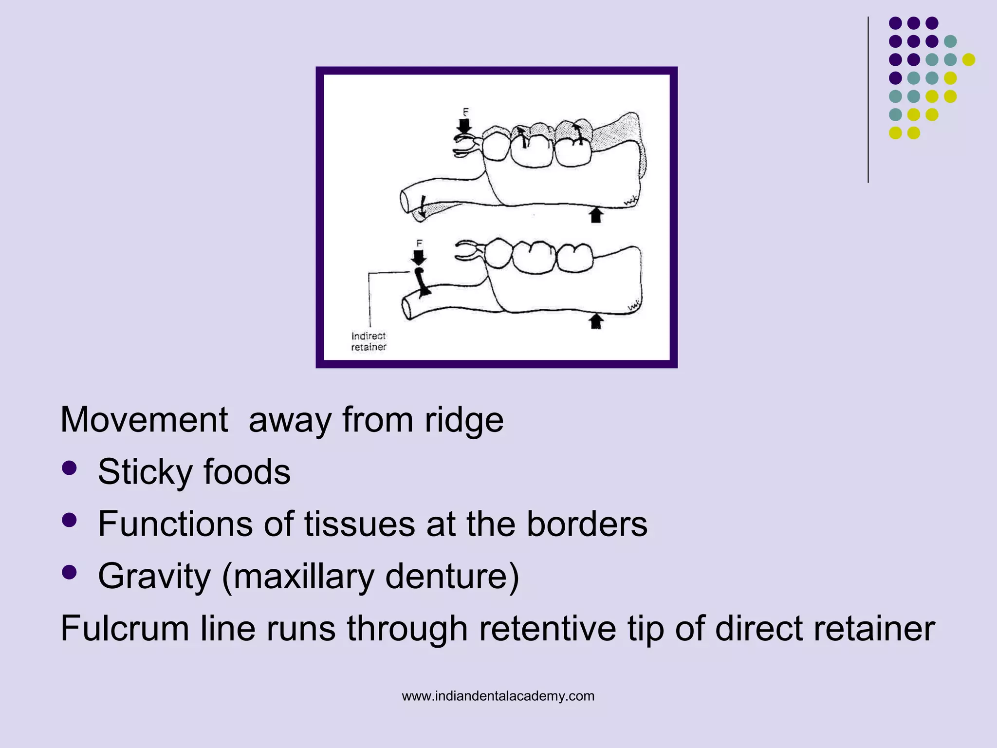 Movement away from ridge
 Sticky foods
 Functions of tissues at the borders
 Gravity (maxillary denture)
Fulcrum line runs through retentive tip of direct retainer
www.indiandentalacademy.com
 
