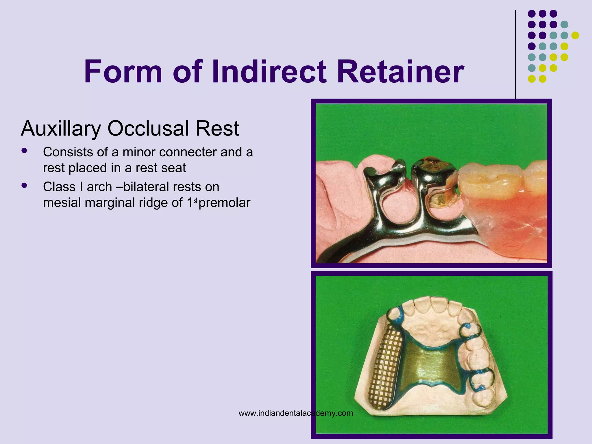 Form of Indirect Retainer
Auxillary Occlusal Rest
 Consists of a minor connecter and a
rest placed in a rest seat
 Class I arch –bilateral rests on
mesial marginal ridge of 1st
premolar
www.indiandentalacademy.com
 