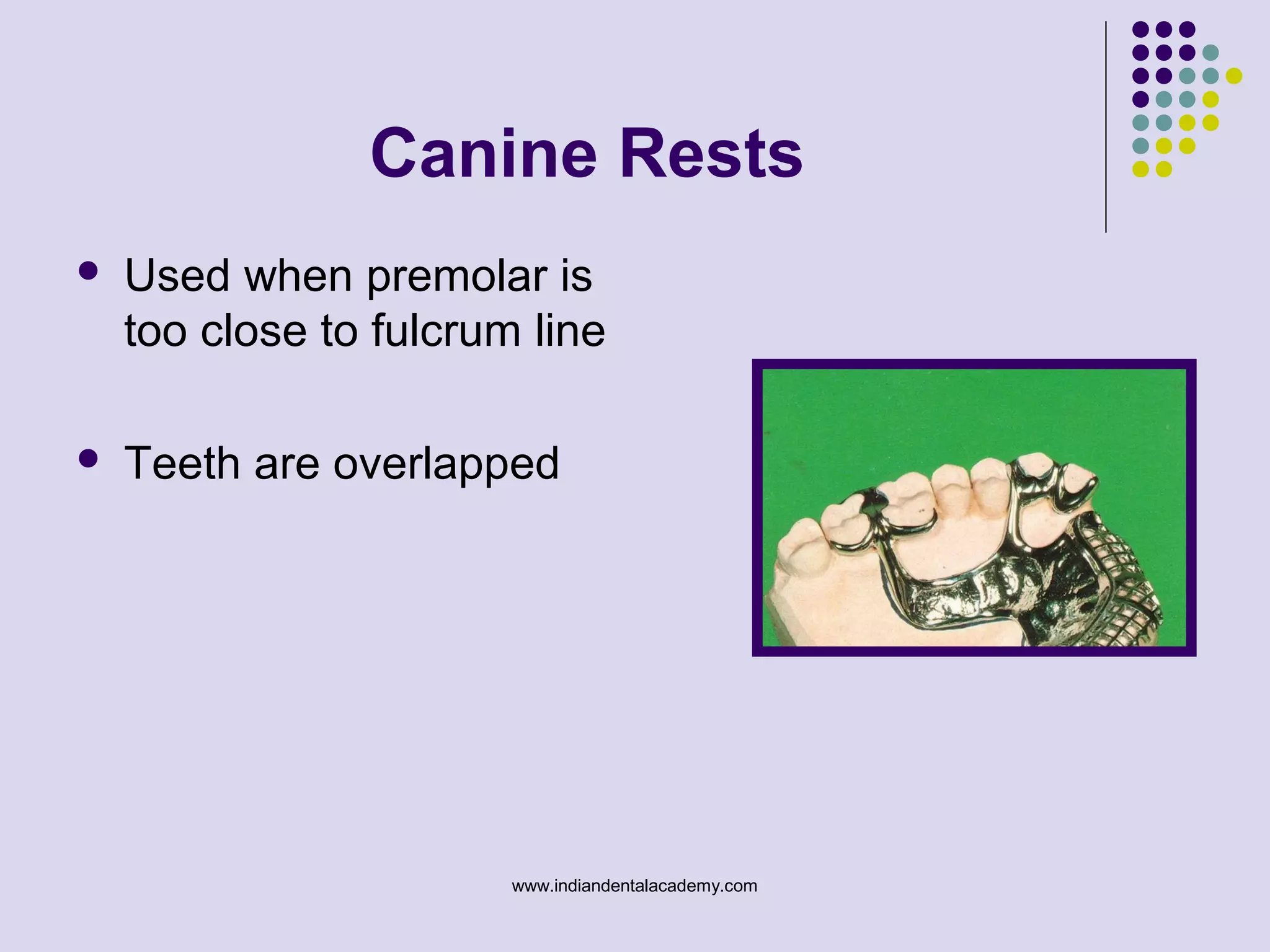 Canine Rests
 Used when premolar is
too close to fulcrum line
 Teeth are overlapped
www.indiandentalacademy.com
 
