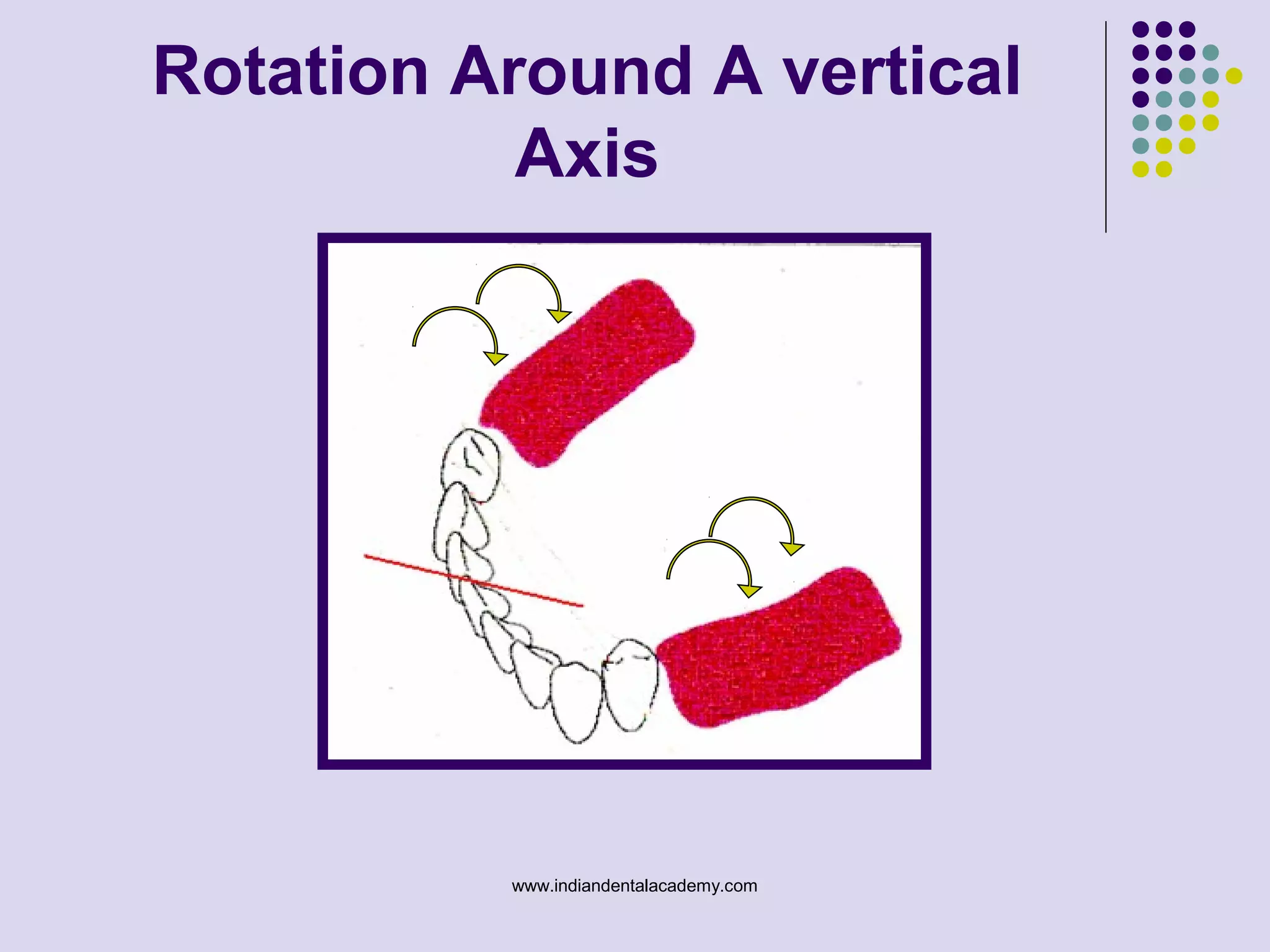 Rotation Around A vertical
Axis
www.indiandentalacademy.com
 