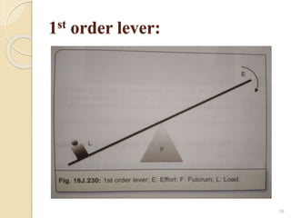 Indirect retainers | PPTX