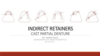 Holding Rpd Retainer INDIRECT RETAINERS IN CAST PARTIAL DENTURES | PPTX
