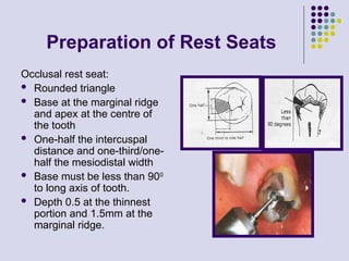 Marginal Ridge Rests Indirect Retainers in free saddle cases. | PPT