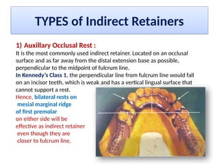 Indiredct Rpd Retainer INDIRECT RETAINERS RPD Dr. Sanket Jadhav | PPTX