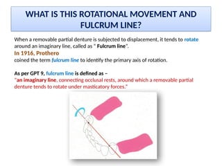 Rotational Rpd Retainer INDIRECT RETAINERS RPD Dr. Sanket Jadhav | PPTX