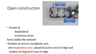 Longitudinal Strut Indirect retainers seminar.pptxasdfghjklbn | PPTX