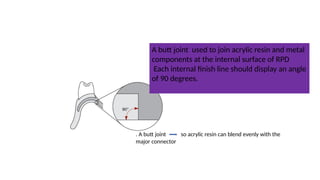 Internal Finish Line Rpd Indirect retainers seminar.pptxasdfghjklbn | PPTX