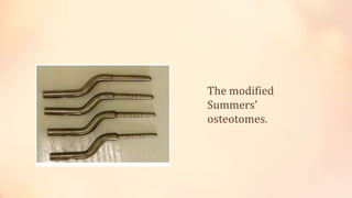 The modified
Summers’
osteotomes.
 