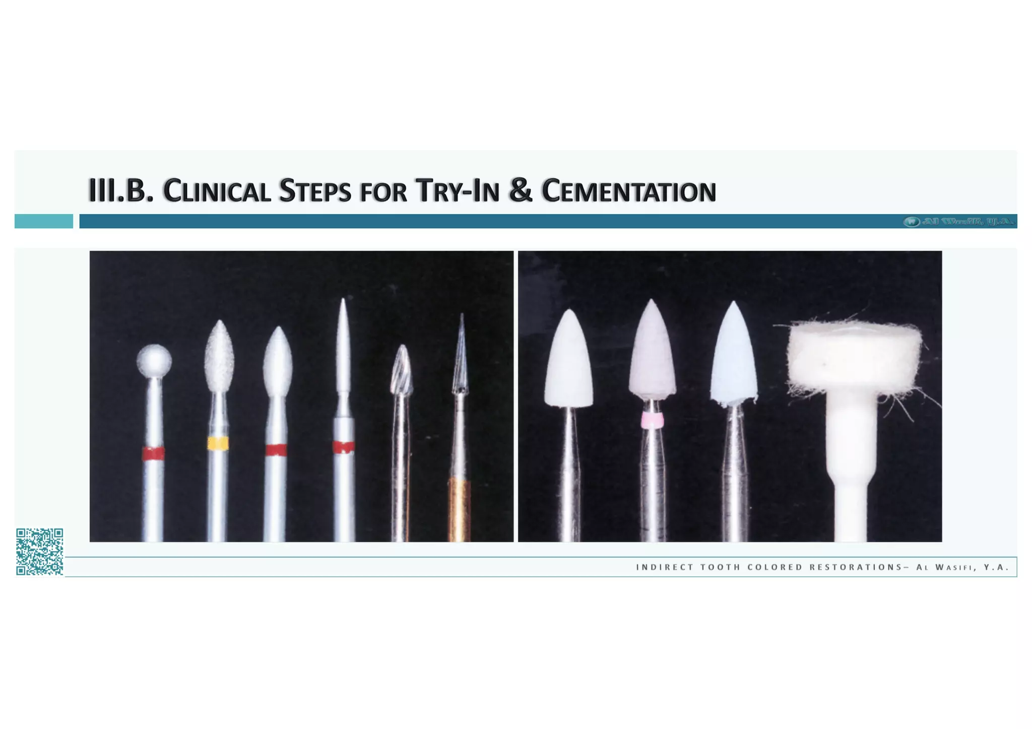 Indirect Tooth Colored Restorations - 2018