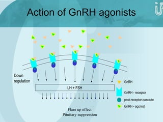 Action of GnRH agonists 
LH + FSH 
GnRH 
GnRH - receptor 
post-receptor-cascade 
GnRH - agonist 
Down 
regulation 
Flare up effect 
Pituitary suppression 
 
