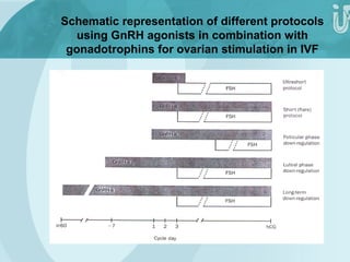 Schematic representation of different protocols 
using GnRH agonists in combination with 
gonadotrophins for ovarian stimulation in IVF 
 