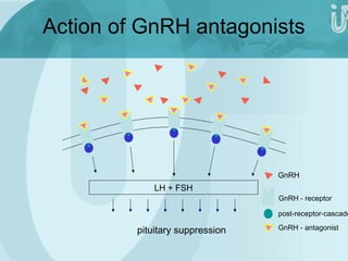 Action of GnRH antagonists 
LH + FSH 
GnRH 
GnRH - receptor 
post-receptor-cascade 
pituitary suppression GnRH - antagonist 
 