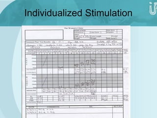 Individualized Stimulation 
 