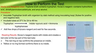 Indole Test- Principle, Reagents, Procedure, Result Interpretation and  Limitations