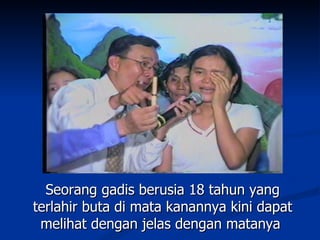 Seorang gadis berusia 18 tahun yang
terlahir buta di mata kanannya kini dapat
 melihat dengan jelas dengan matanya
 