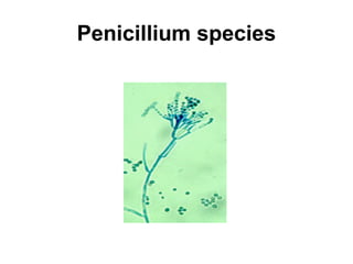 Penicillium species 
 