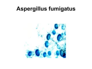 Aspergillus fumigatus 
 