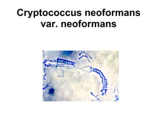 Cryptococcus neoformans 
var. neoformans 
 