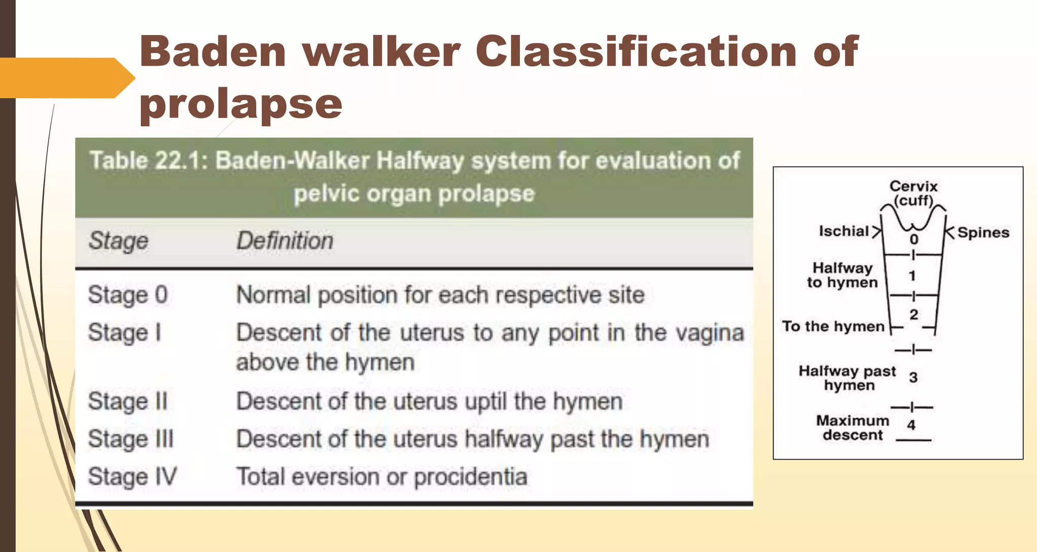 Disc Prolapse Classification Classification & conservative surgeries for prolapse | PPTX