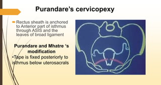 Purandare’s cervicopexy
Rectus sheath is anchored
to Anterior part of isthmus
through ASIS and the
leaves of broad ligament
Purandare and Mhatre ‘s
modification
•Tape is fixed posteriorly to
isthmus below uterosacrals
 