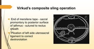 Virkud’s composite sling operation
 End of mersilene tape - sacral
promontory to posterior surface
of isthmus - sutured to rectus
sheath
 Plication of left side uterosacral
ligament to correct
dextrorotation
 