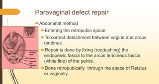 Paravaginal defect repair
Abdominal method
Entering the retropubic space
To correct detachment between vagina and arcus
tendinus
Repair is done by fixing (reattaching) the
endopelvic fascia to the arcus tendineus fascia
(white line) of the pelvis.
Done retropubically through the space of Retzius
or vaginally.
 