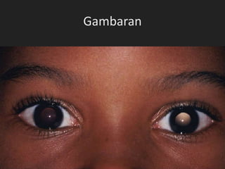 Gambaran
 