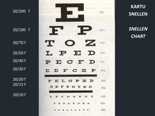KARTU
SNELLEN
SNELLEN
CHART
20/200 f
20/100 f
20/70 f
20/50 f
20/40 f
20/30 f
20/20 f
20/15 f
20/10 f
 