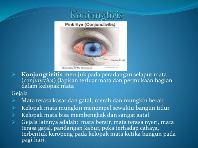 Alat Eksresi : Indra Penglihatan Mata