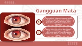 Gangguan Mata
Konjungtivitis: Peradangan pada selaput
mata (konjungtiva) yang menyebabkan
mata merah, gatal, dan berair. Dapat
disebabkan oleh infeksi bakteri, virus,
atau alergi.
Rabun Senja: Gangguan penglihatan
pada kondisi cahaya redup akibat
kekurangan vitamin A. Penderita sulit
melihat saat malam hari atau di tempat
gelap.
 