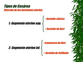 Induccion del trabajo de parto | PPT