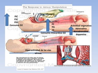 Actividad vegetativa Adrenalina Noradrenalina dopamina Hiperactividad de las vías aéreas PIC FSC PIO Consumo O2 FC  PA IC Consumo miocardico O2 
