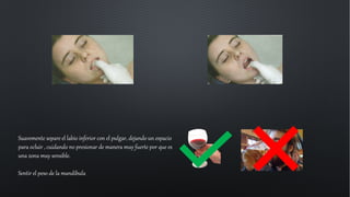 Suavemente separe el labio inferior con el pulgar, dejando un espacio
para ocluir , cuidando no presionar de manera muy fuerte por que es
una zona muy sensible.
Sentir el peso de la mandíbula
 