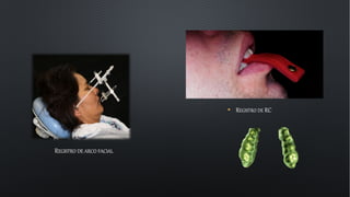 REGISTRO DE ARCO FACIAL
• REGISTRO DE RC
 