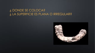 ¿ DONDE SE COLOCA?
¿ LA SUPERFICIE ES PLANA O IRREGULAR?
 