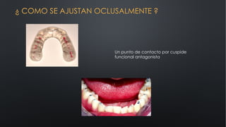 ¿ COMO SE AJUSTAN OCLUSALMENTE ?
Un punto de contacto por cuspide
funcional antagonista
 