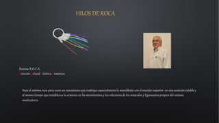 HILOS DE ROCA
Sistema R.O.C.A.
Relación Oclusal Céntrica Armónica
Nace el sistema roca para crear un mecanismo que reubique espacialmente la mandíbula con el maxilar superior en una posición estable y
al mismo tiempo que restablezca la armonía en los movimientos y las relaciones de los músculos y ligamentos propios del sistema
masticatorio.
 