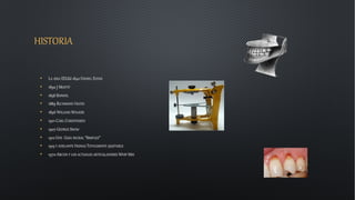 HISTORIA
• LA 1ERA EEUU 1840 DANIEL EVENS
• 1890 J MOFFIT
• 1858 BONWIL
• 1889 RICHMOND HAYES
• 1896 WILLIAM WALKER
• 1901 CARL CHRISTENSEN
• 1907 GEORGE SNOW
• 1912 GYSI GUIA INCISAL “SIMPLEX”
• 1915 Y ADELANTE HANAU TOTALMENTE AJUSTABLE
• 1970 ARCON Y LOS ACTUALES ARTICULADORES WHIP MIX
 