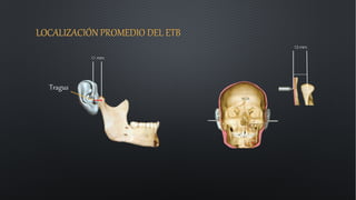LOCALIZACIÓN PROMEDIO DEL ETB
12 mm.
Tragus
11 mm.
 