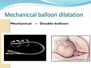 Induction and augmentation of labour | PPTX