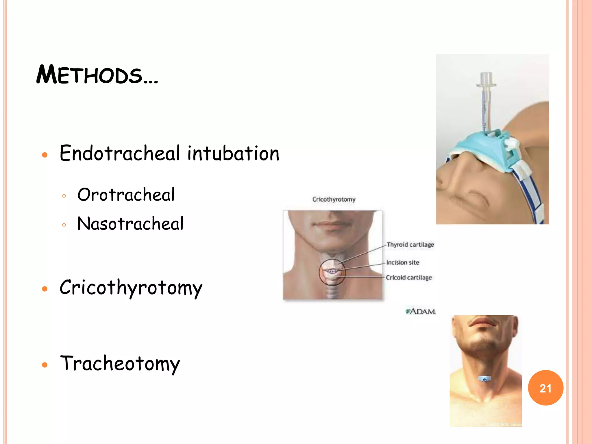 METHODS…
 Endotracheal intubation
◦ Orotracheal
◦ Nasotracheal
 Cricothyrotomy
 Tracheotomy
21
 